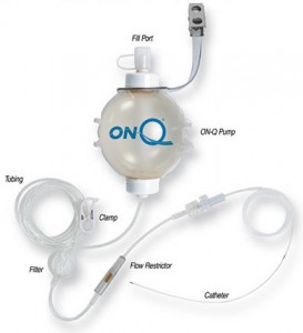 on-q pain pump